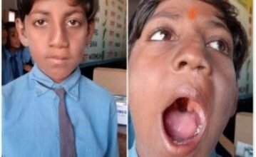 चिकित्सा के क्षेत्र में आयुष्मान और चिरायु योजना से नौनिहालों को मिल रहा जीवनदान